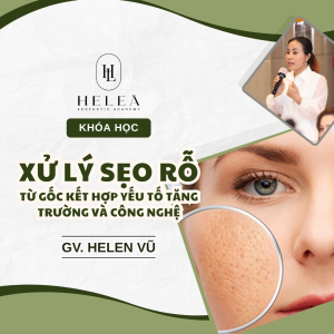 Xử Lý Sẹo Rỗ Từ Gốc Kết Hợp Yếu Tố Tăng Trường Và Công Nghệ